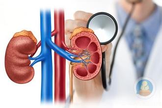 肾功能衰竭是什么原因引起的? 引起肾功能衰竭