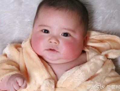 宝宝脸上红苹果 危险信号需当心-3158母婴网